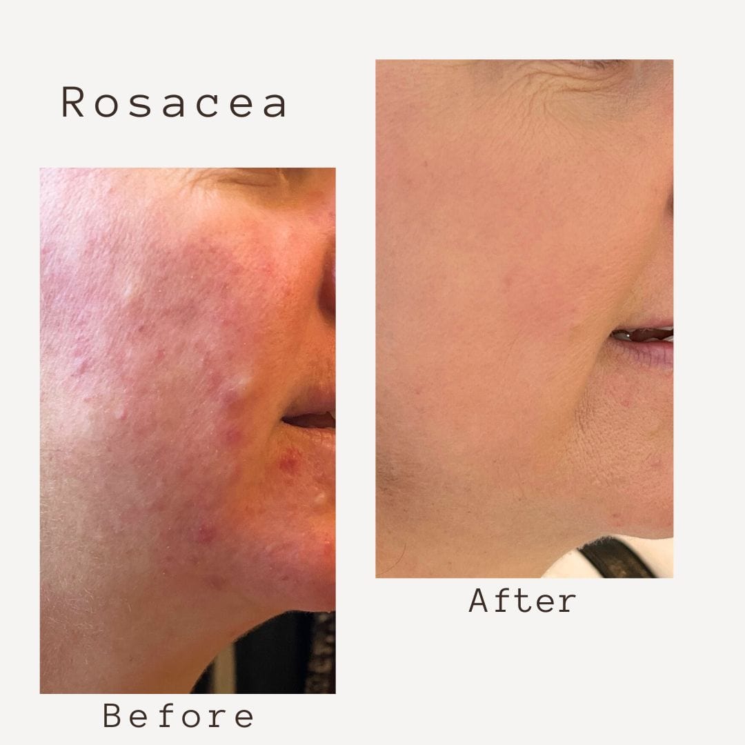 Corbin Rd Cream 4-in-1  SMART Moisture-Mist