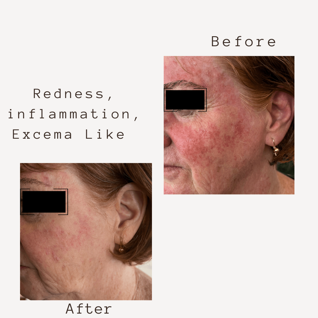 Corbin Rd Cream SMART 5 in 1  FACE CREAM