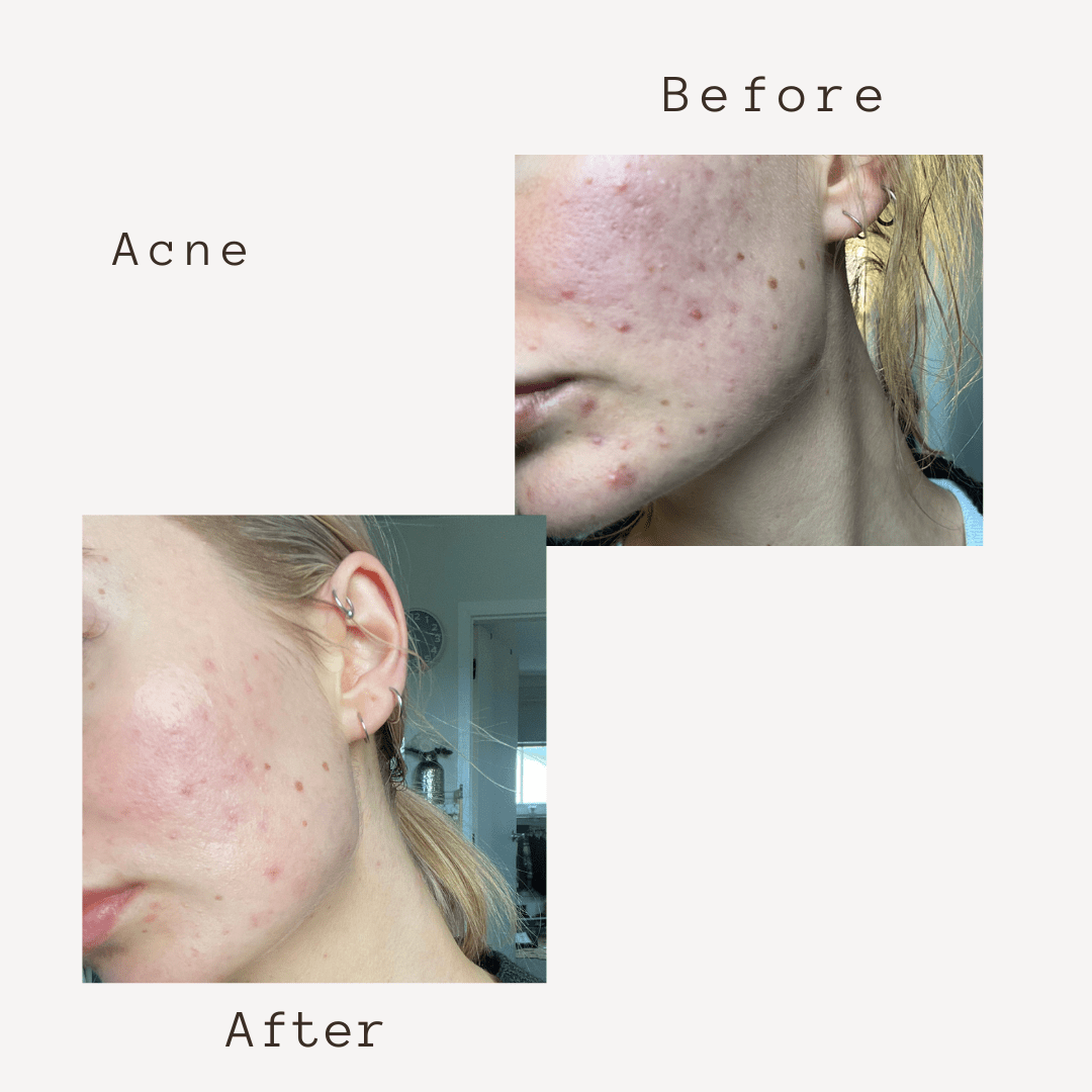 Corbin Rd Cream SMART 5 in 1  FACE CREAM