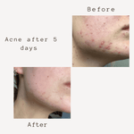 Corbin Rd Cream SMART 5 in 1  FACE CREAM