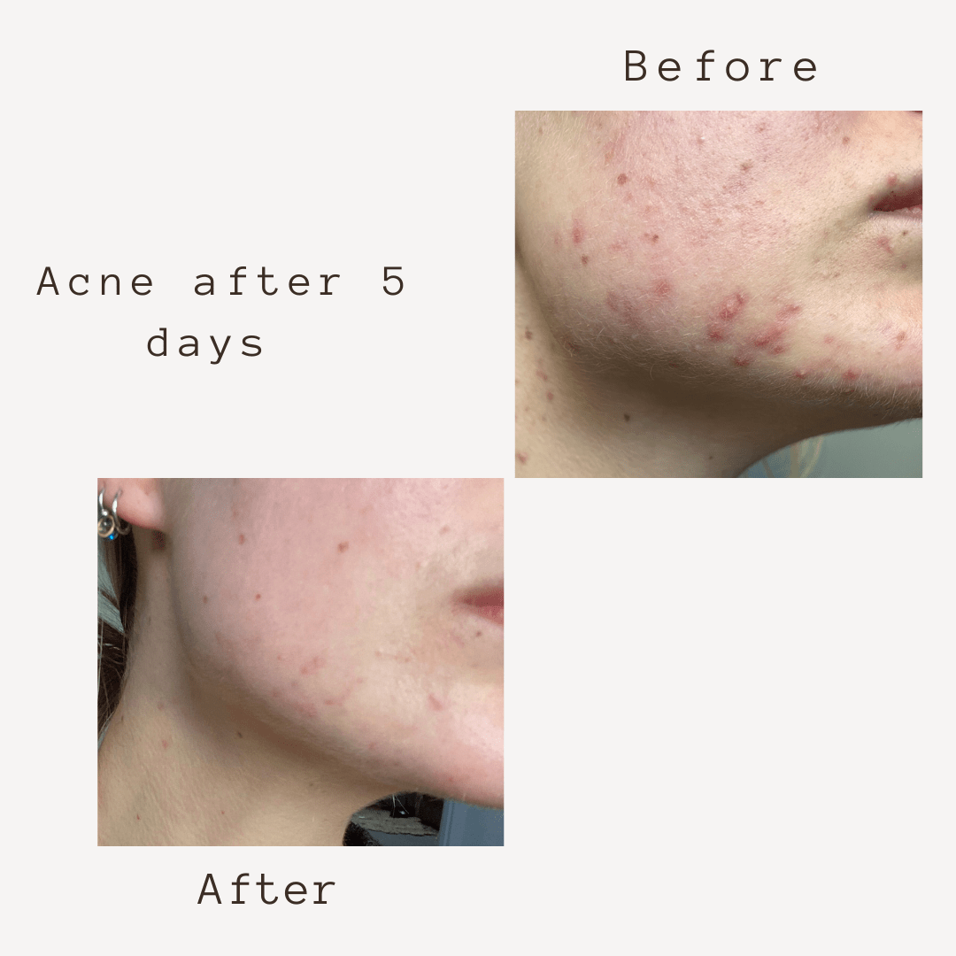 Corbin Rd Cream SMART 5 in 1  FACE CREAM