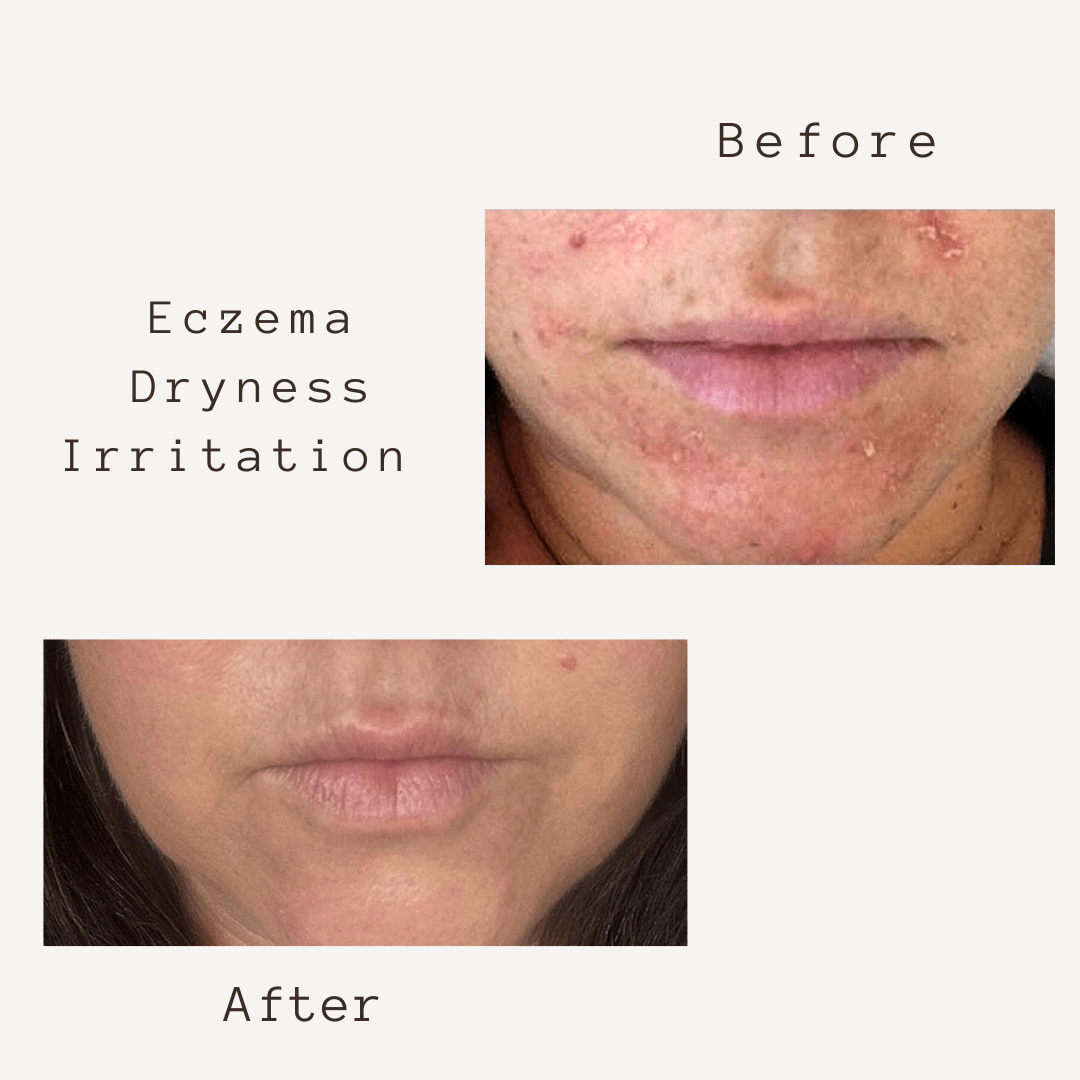 Corbin Rd Cream SMART 5 in 1  FACE CREAM