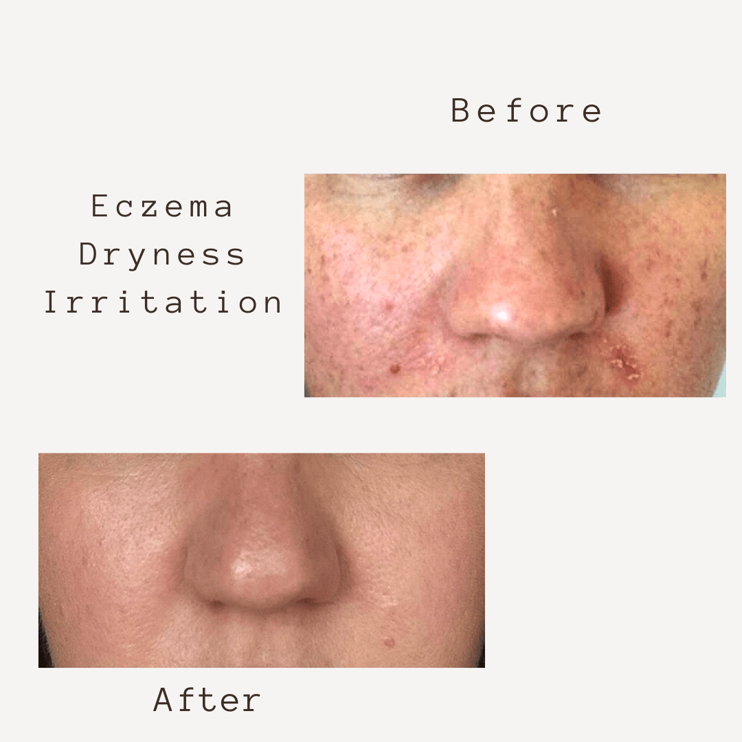 Corbin Rd Cream SMART 5 in 1  FACE CREAM