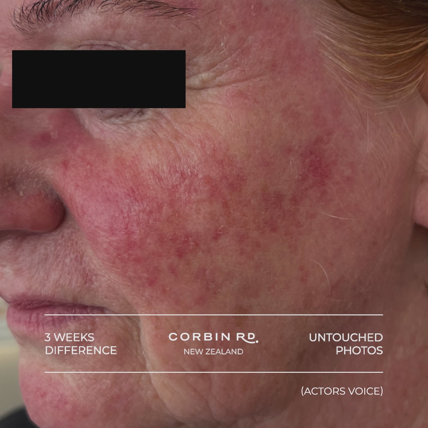 Restorative Cleansing Balm