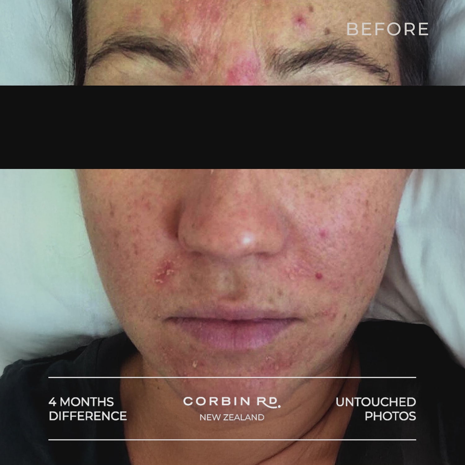 Multi Vitamin Face Oil